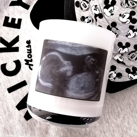 Design Your Own | Personalised | BABY SCAN | Photo | Boxed Soy Candle | New Baby | Mum To Be